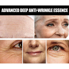 Anti-wrinkle