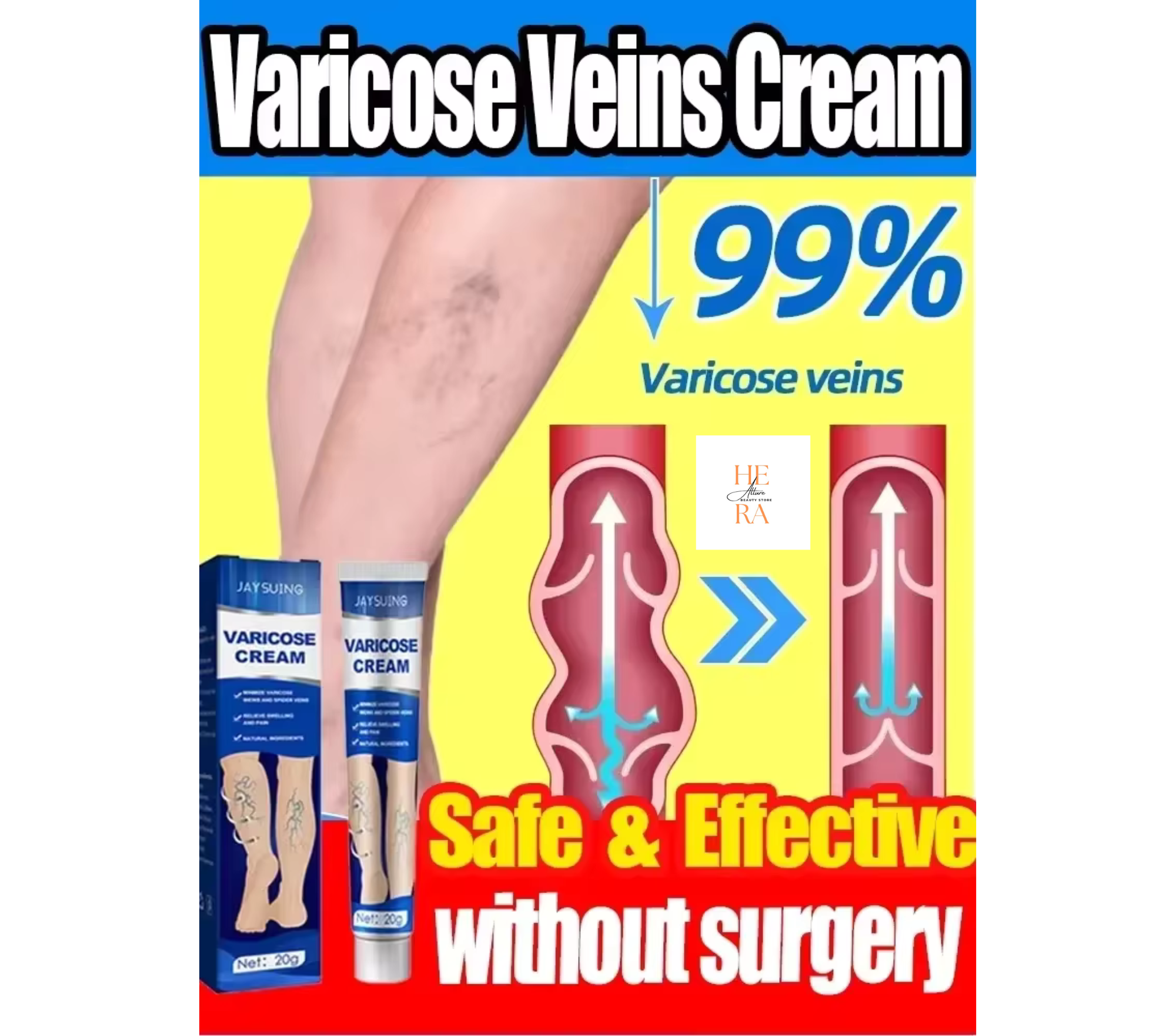 Ointment for Varicose Veins Eliminate Vasculitis Phlebitis