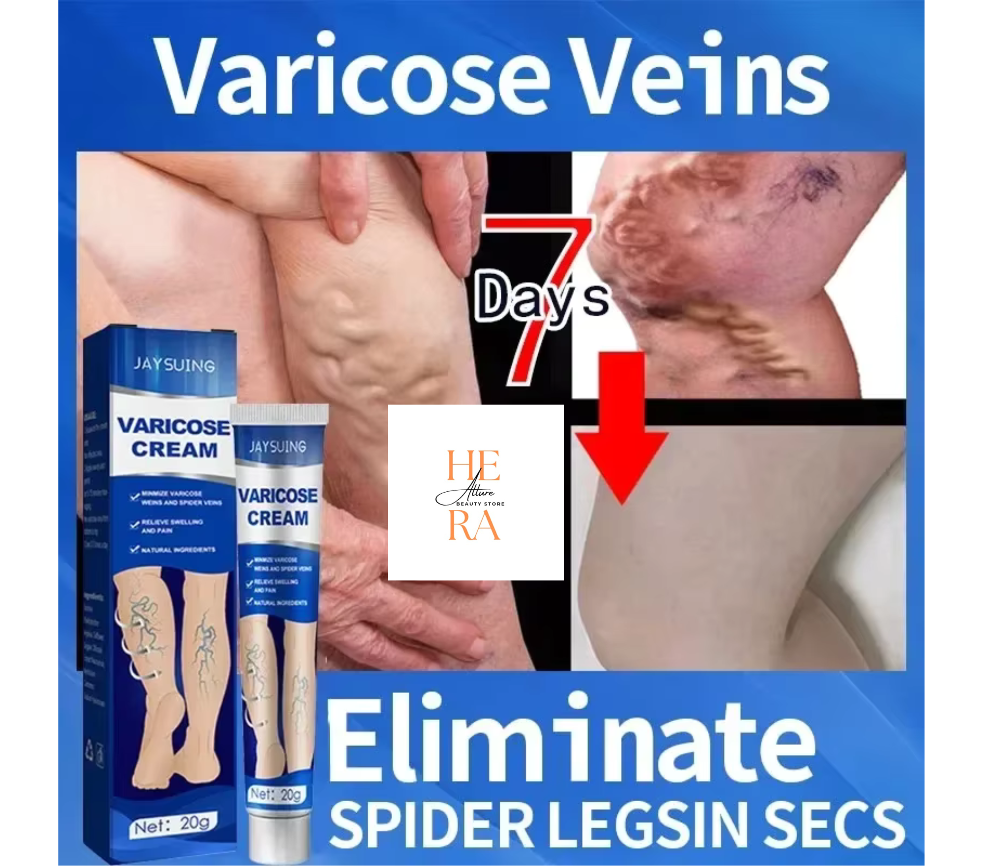 Ointment for Varicose Veins Eliminate Vasculitis Phlebitis