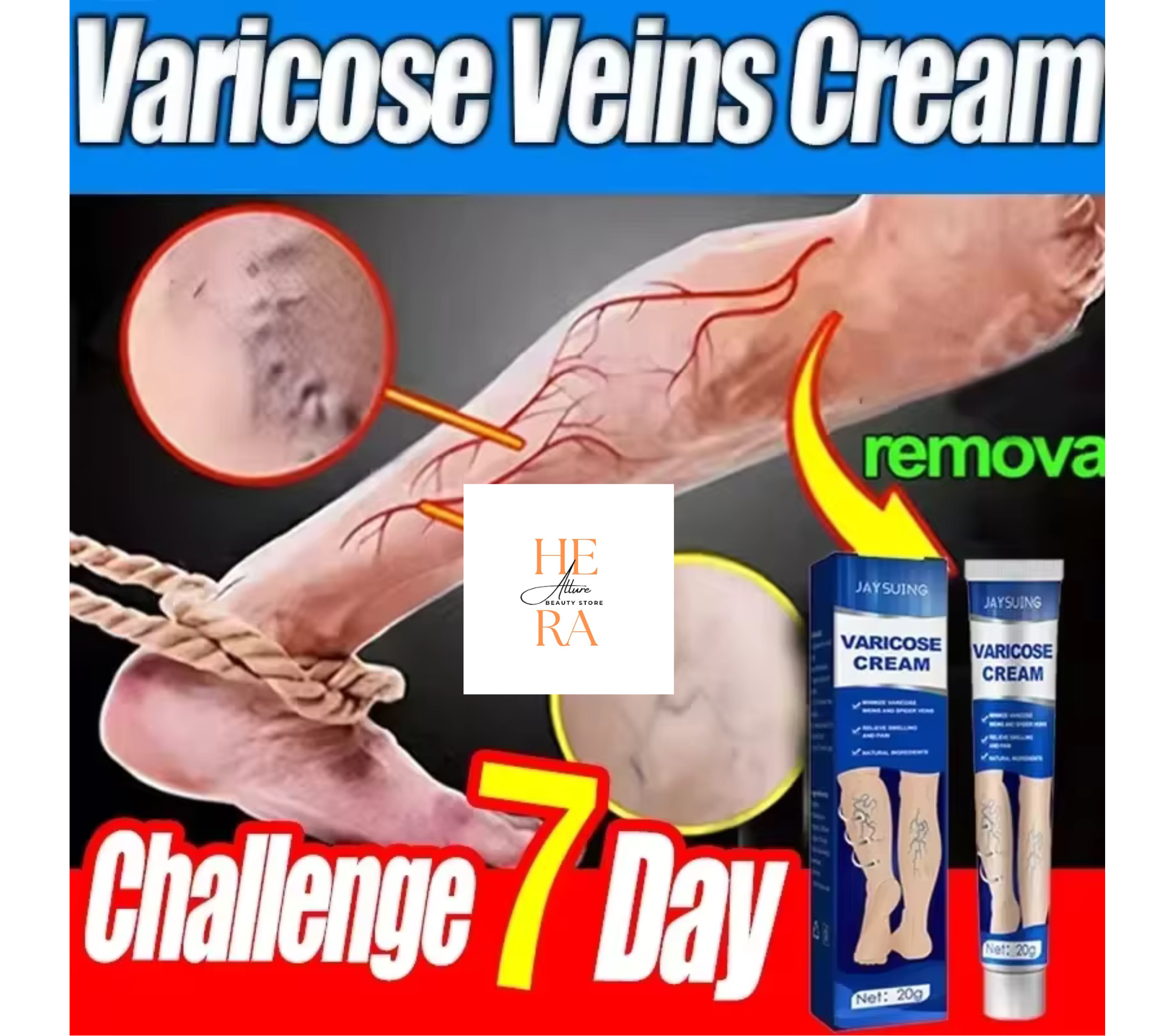 Ointment for Varicose Veins Eliminate Vasculitis Phlebitis